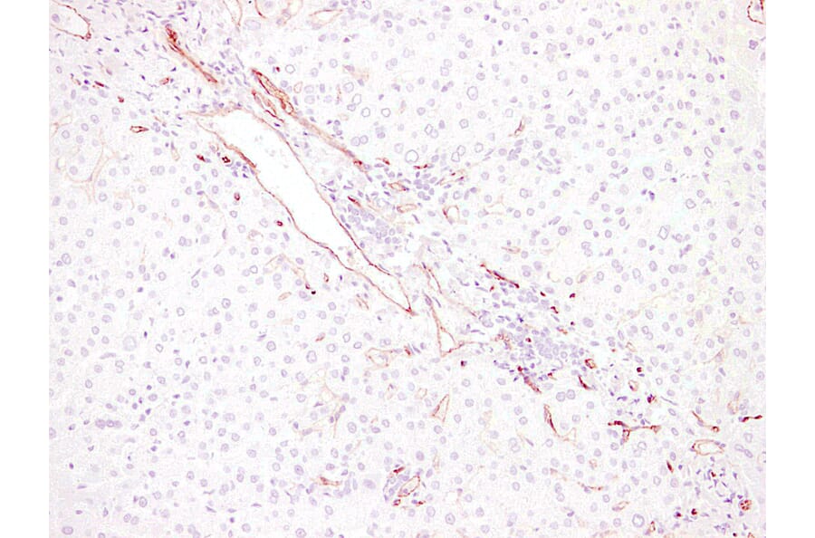 Immunohistochemistry - Anti-CD34 Antibody (V0023) - Antibodies.com