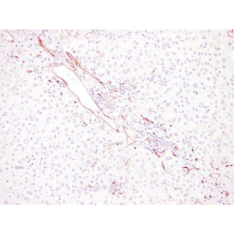 Immunohistochemistry - Anti-CD34 Antibody (V0023) - Antibodies.com