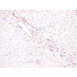 Immunohistochemistry - Anti-CD34 Antibody (V0023) - Antibodies.com