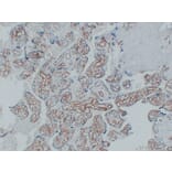Immunohistochemistry - Anti-CD34 Antibody (V0023) - Antibodies.com