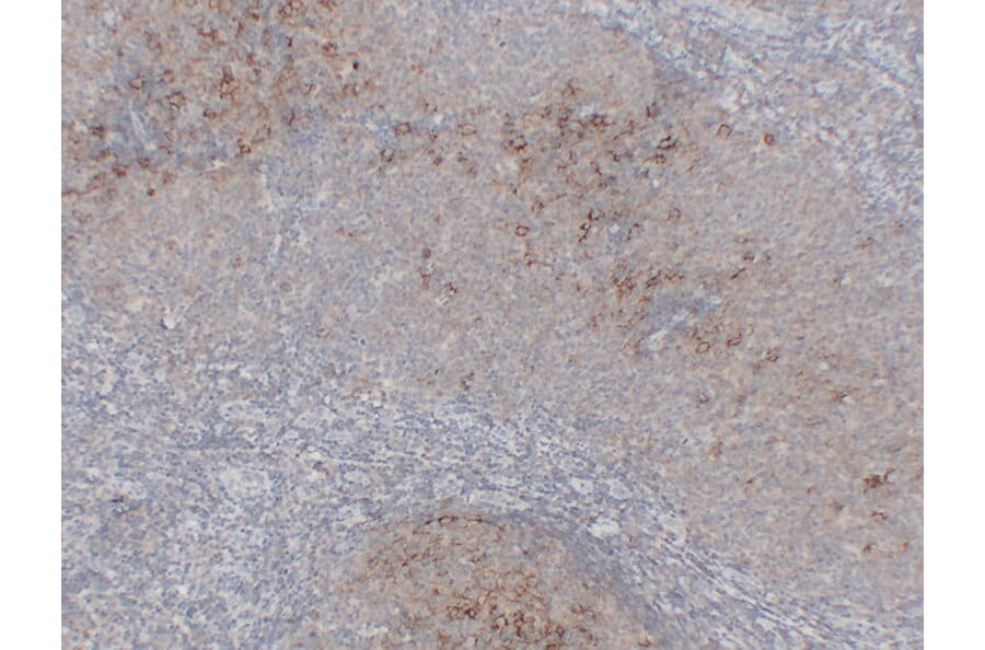 Immunohistochemistry - Anti-CD23 Antibody (V0021) - Antibodies.com