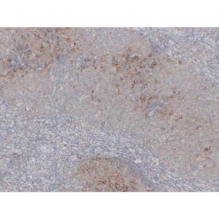 Immunohistochemistry - Anti-CD23 Antibody (V0021) - Antibodies.com