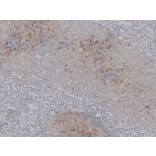 Immunohistochemistry - Anti-CD23 Antibody (V0021) - Antibodies.com