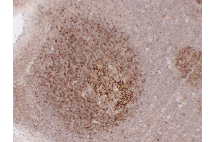Immunohistochemistry - Anti-CD23 Antibody (V0021) - Antibodies.com