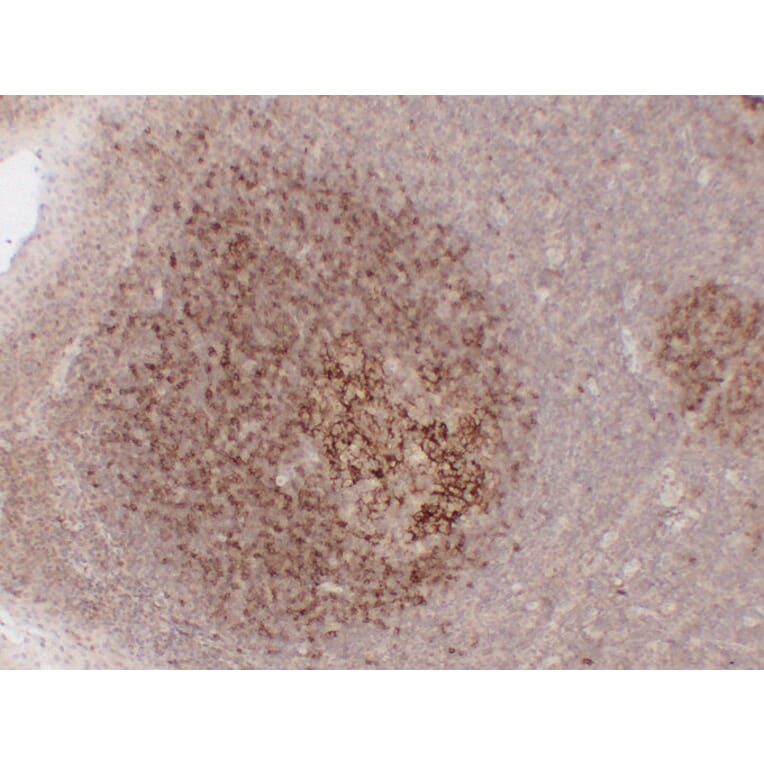 Immunohistochemistry - Anti-CD23 Antibody (V0021) - Antibodies.com