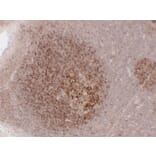 Immunohistochemistry - Anti-CD23 Antibody (V0021) - Antibodies.com