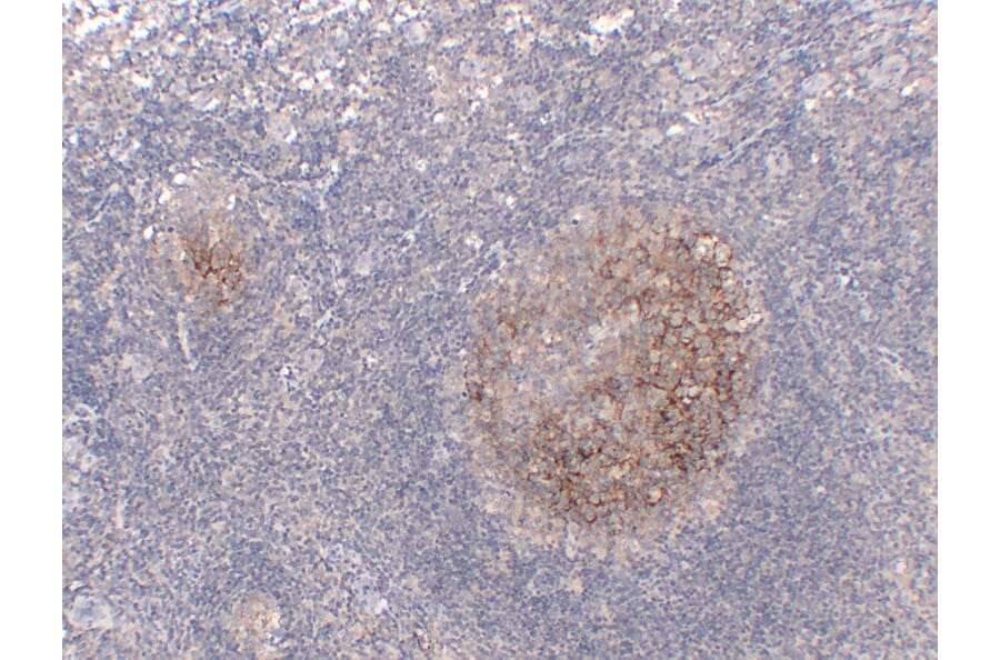 Immunohistochemistry - Anti-CD23 Antibody (V0021) - Antibodies.com