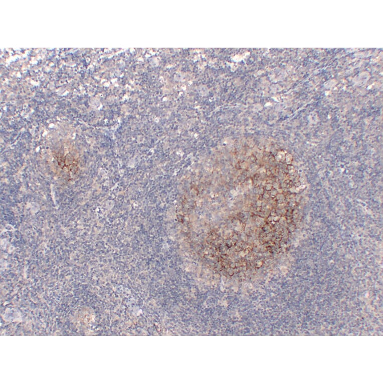 Immunohistochemistry - Anti-CD23 Antibody (V0021) - Antibodies.com