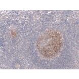 Immunohistochemistry - Anti-CD23 Antibody (V0021) - Antibodies.com