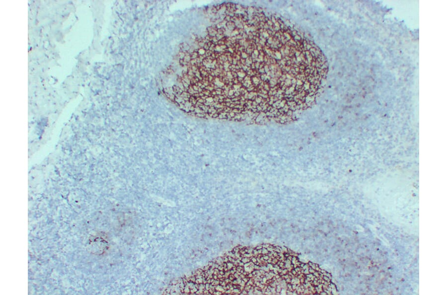 Immunohistochemistry - Anti-CD23 Antibody (V0021) - Antibodies.com