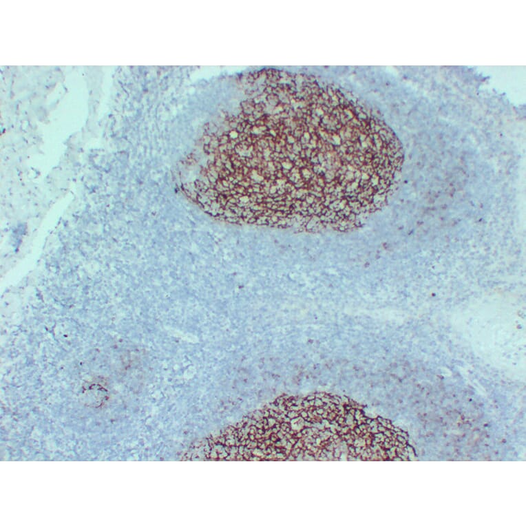 Immunohistochemistry - Anti-CD23 Antibody (V0021) - Antibodies.com