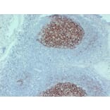 Immunohistochemistry - Anti-CD23 Antibody (V0021) - Antibodies.com