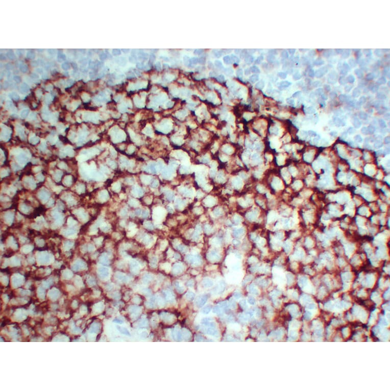 Immunohistochemistry - Anti-CD23 Antibody (V0021) - Antibodies.com