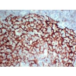 Immunohistochemistry - Anti-CD23 Antibody (V0021) - Antibodies.com