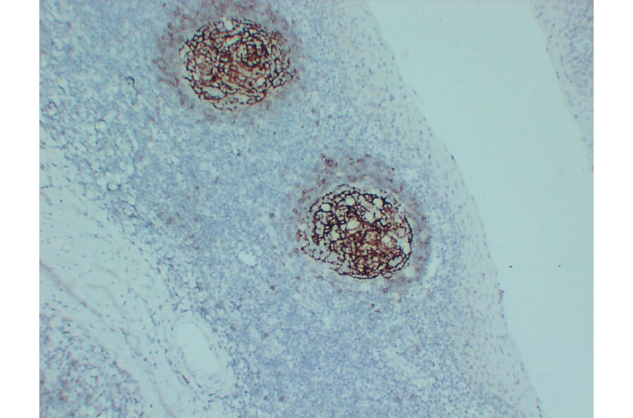 Immunohistochemistry - Anti-CD23 Antibody (V0021) - Antibodies.com