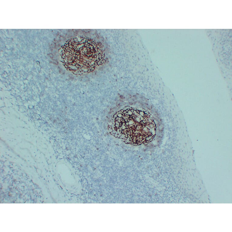 Immunohistochemistry - Anti-CD23 Antibody (V0021) - Antibodies.com