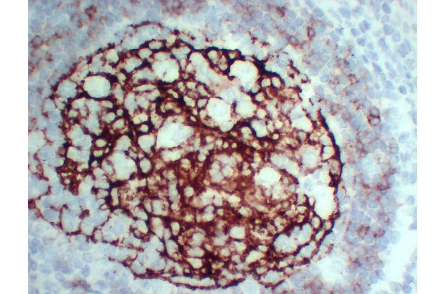 Immunohistochemistry - Anti-CD23 Antibody (V0021) - Antibodies.com