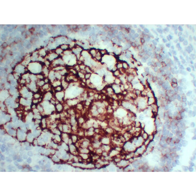 Immunohistochemistry - Anti-CD23 Antibody (V0021) - Antibodies.com