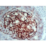Immunohistochemistry - Anti-CD23 Antibody (V0021) - Antibodies.com