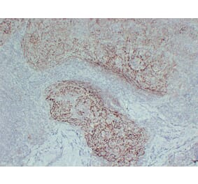Immunohistochemistry - Anti-CD21 Antibody (V0020) - Antibodies.com