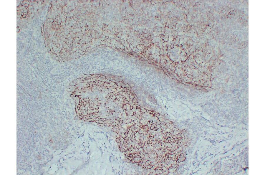 Immunohistochemistry - Anti-CD21 Antibody (V0020) - Antibodies.com