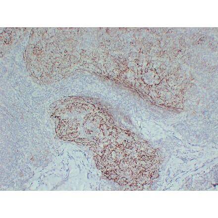 Immunohistochemistry - Anti-CD21 Antibody (V0020) - Antibodies.com