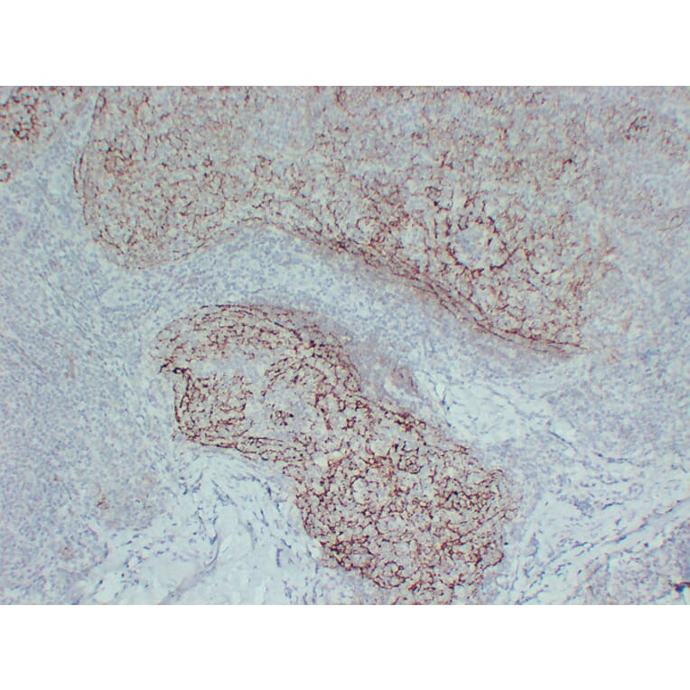 Immunohistochemistry - Anti-CD21 Antibody (V0020) - Antibodies.com