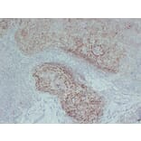 Immunohistochemistry - Anti-CD21 Antibody (V0020) - Antibodies.com