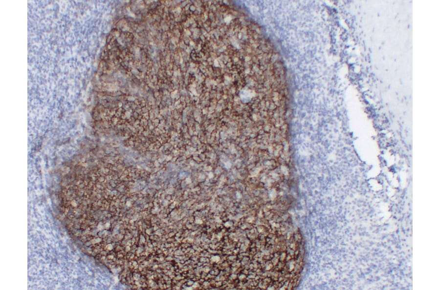 Immunohistochemistry - Anti-CD21 Antibody (V0020) - Antibodies.com
