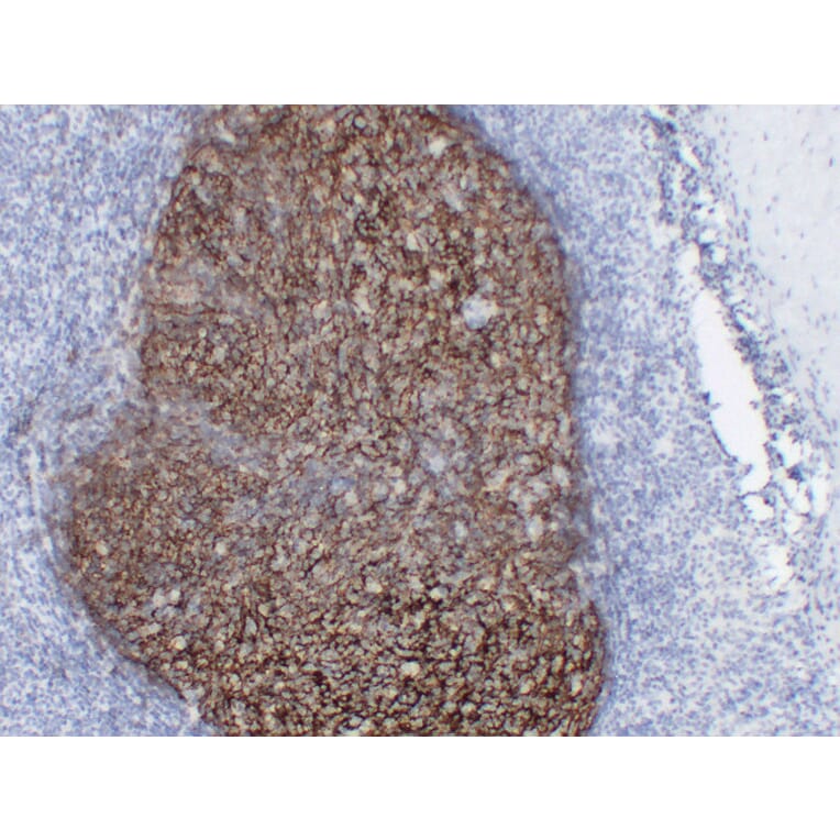 Immunohistochemistry - Anti-CD21 Antibody (V0020) - Antibodies.com
