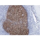 Immunohistochemistry - Anti-CD21 Antibody (V0020) - Antibodies.com