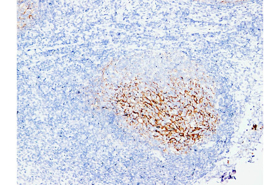 Immunohistochemistry - Anti-CD21 Antibody (V0020) - Antibodies.com
