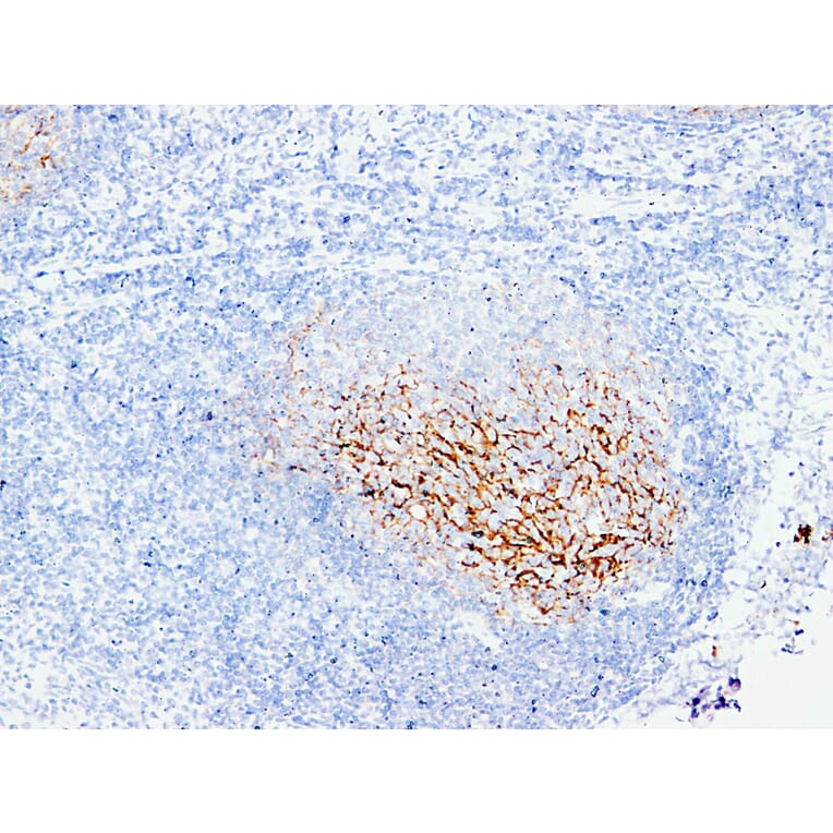 Immunohistochemistry - Anti-CD21 Antibody (V0020) - Antibodies.com