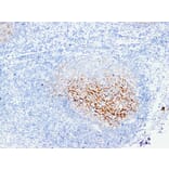 Immunohistochemistry - Anti-CD21 Antibody (V0020) - Antibodies.com