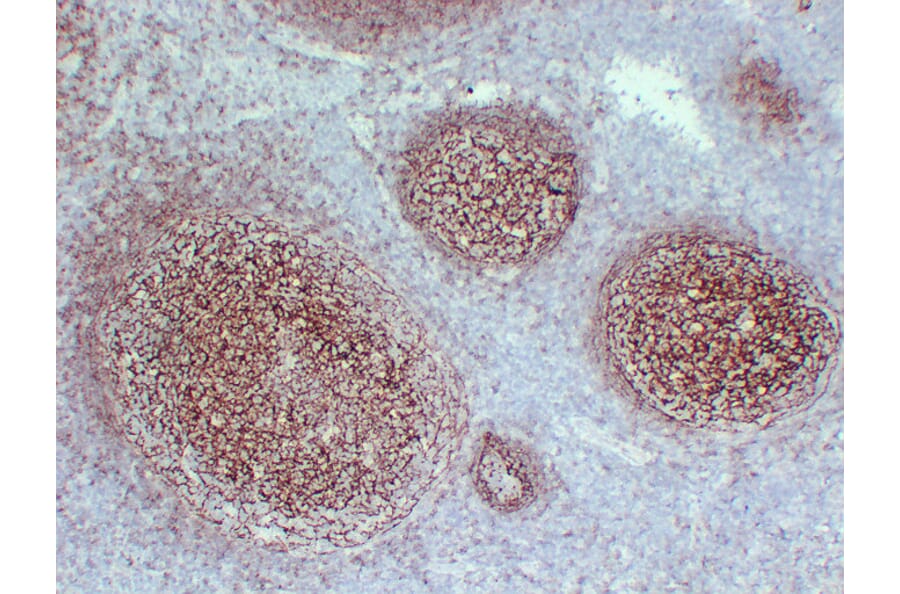 Immunohistochemistry - Anti-CD21 Antibody (V0020) - Antibodies.com