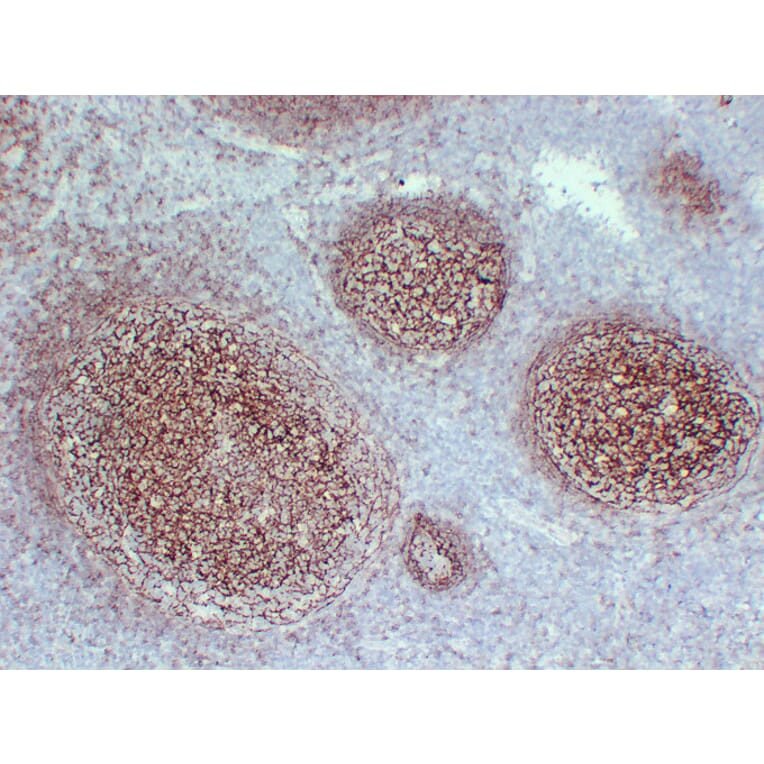Immunohistochemistry - Anti-CD21 Antibody (V0020) - Antibodies.com