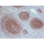 Immunohistochemistry - Anti-CD21 Antibody (V0020) - Antibodies.com