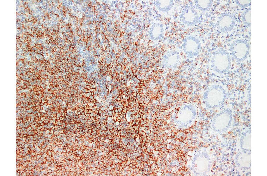 Immunohistochemistry - Anti-CD20 Antibody (V0019) - Antibodies.com