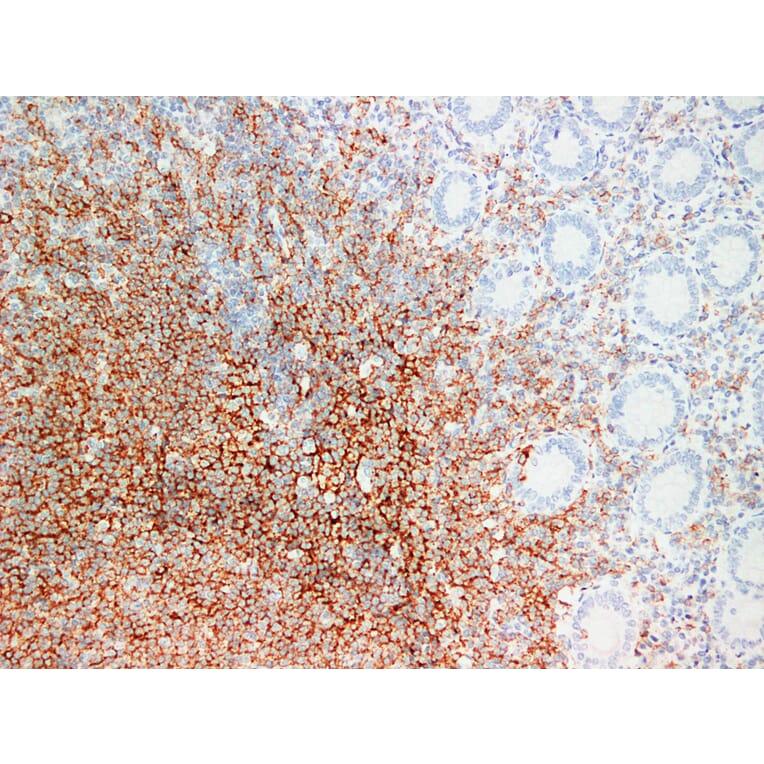 Immunohistochemistry - Anti-CD20 Antibody (V0019) - Antibodies.com