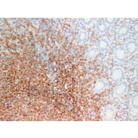 Immunohistochemistry - Anti-CD20 Antibody (V0019) - Antibodies.com