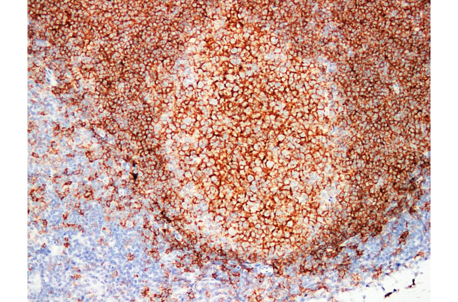 Immunohistochemistry - Anti-CD20 Antibody (V0019) - Antibodies.com