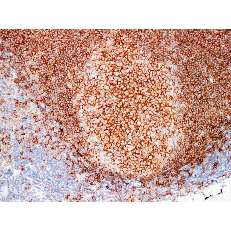 Immunohistochemistry - Anti-CD20 Antibody (V0019) - Antibodies.com