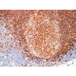 Immunohistochemistry - Anti-CD20 Antibody (V0019) - Antibodies.com