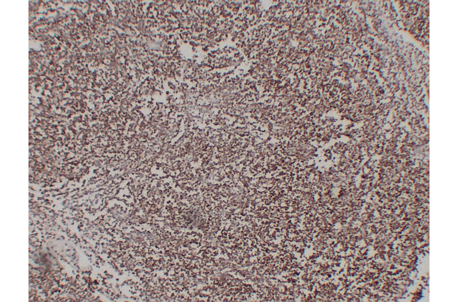Immunohistochemistry - Anti-CD1a Antibody (V0018) - Antibodies.com