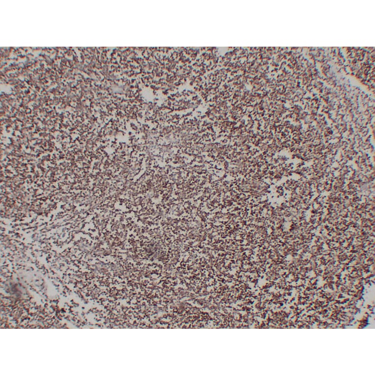 Immunohistochemistry - Anti-CD1a Antibody (V0018) - Antibodies.com