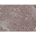 Immunohistochemistry - Anti-CD1a Antibody (V0018) - Antibodies.com