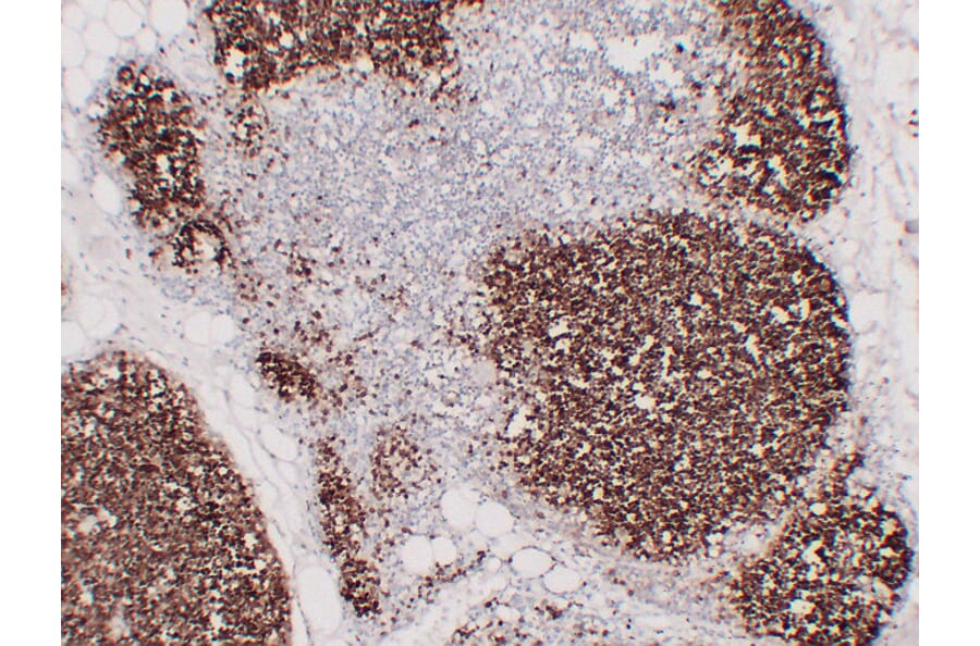 Immunohistochemistry - Anti-CD1a Antibody (V0018) - Antibodies.com