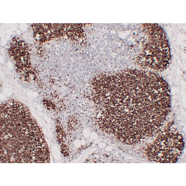 Immunohistochemistry - Anti-CD1a Antibody (V0018) - Antibodies.com