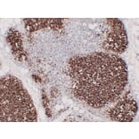 Immunohistochemistry - Anti-CD1a Antibody (V0018) - Antibodies.com