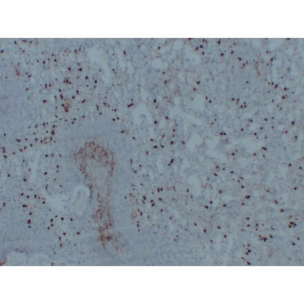 Immunohistochemistry - Anti-CD14 Antibody (V0016) - Antibodies.com